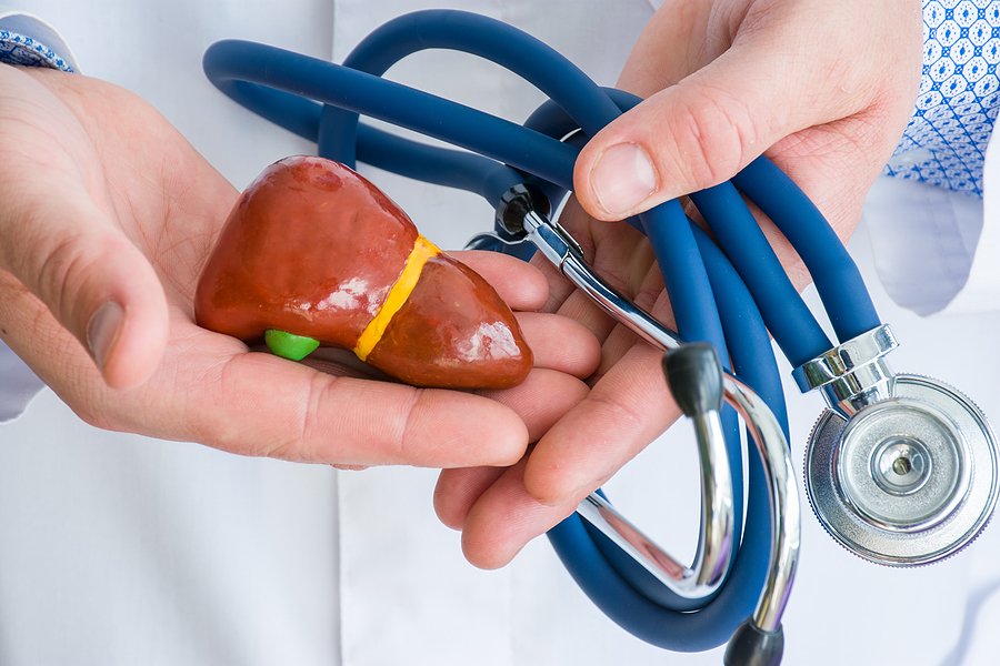 5 Cara Mengurangi Risiko Lemak di Hati Tanpa Obat